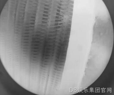胴体扫描仪的几大特点